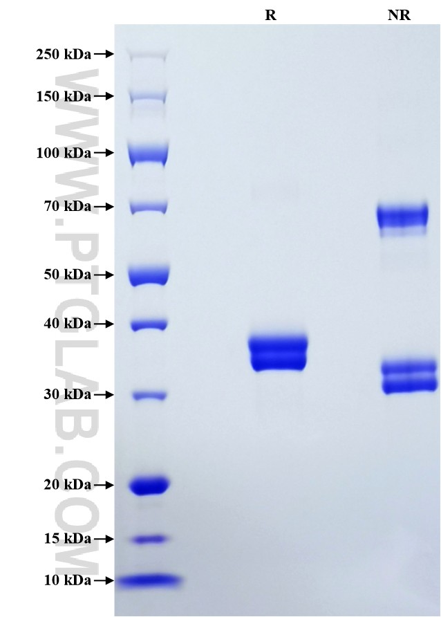 Purity of Recombinant Human CXCL5 was determined by SDS-PAGE. The protein was resolved in an SDS-PAGE in reducing (R) and non-reducing (NR) conditions and stained using Coomassie blue.