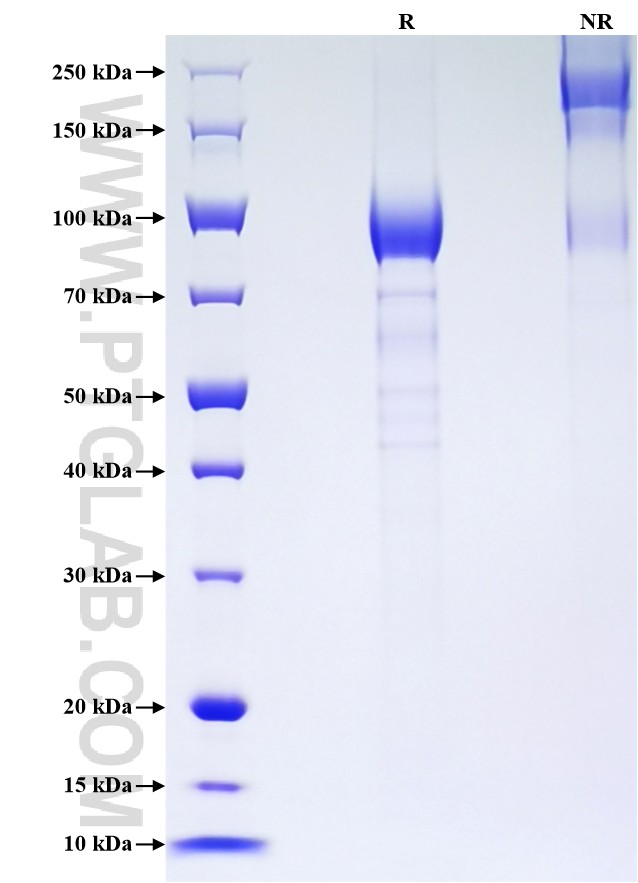 Purity of Recombinant Human THPO was determined by SDS-PAGE. The protein was resolved in an SDS-PAGE in reducing (R) and non-reducing (NR) conditions and stained using Coomassie blue. Purity of Recombinant Human THPO was determined by SDS-PAGE. The protein was resolved in an SDS-PAGE in reducing (R) and non-reducing (NR) conditions and stained using Coomassie blue.