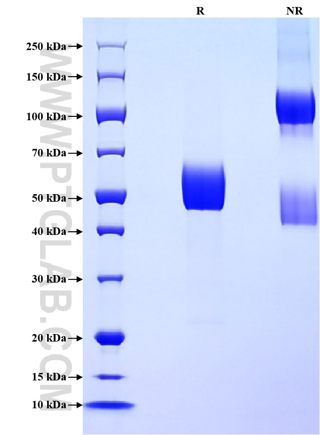 Purity of Recombinant Human TGFBR2 was determined by SDS-PAGE. The protein was resolved in an SDS-PAGE in reducing (R) and non-reducing (NR) conditions and stained using Coomassie blue.
