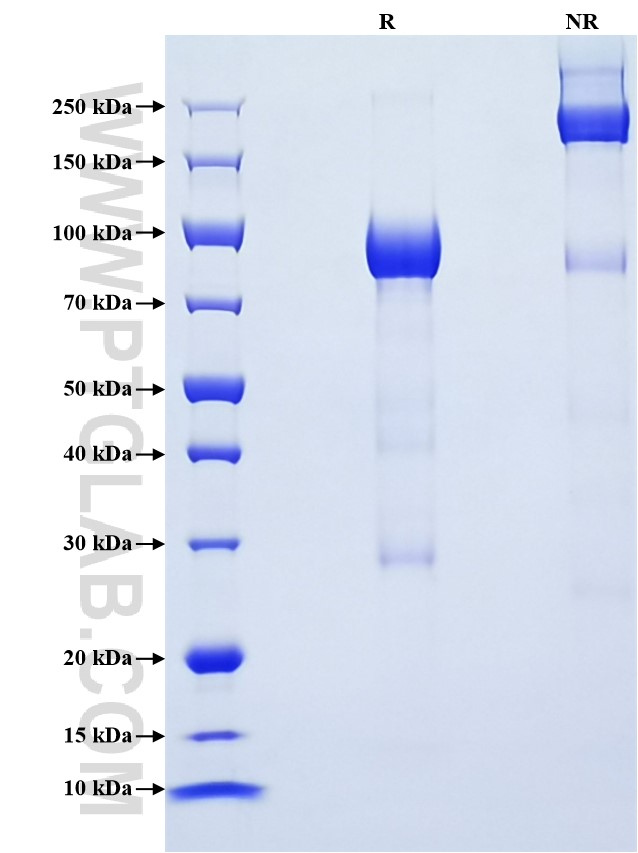 Purity of Recombinant Human DSG3 was determined by SDS-PAGE. The protein was resolved in an SDS-PAGE in reducing (R) and non-reducing (NR) conditions and stained using Coomassie blue. Purity of Recombinant Human DSG3 was determined by SDS-PAGE. The protein was resolved in an SDS-PAGE in reducing (R) and non-reducing (NR) conditions and stained using Coomassie blue.