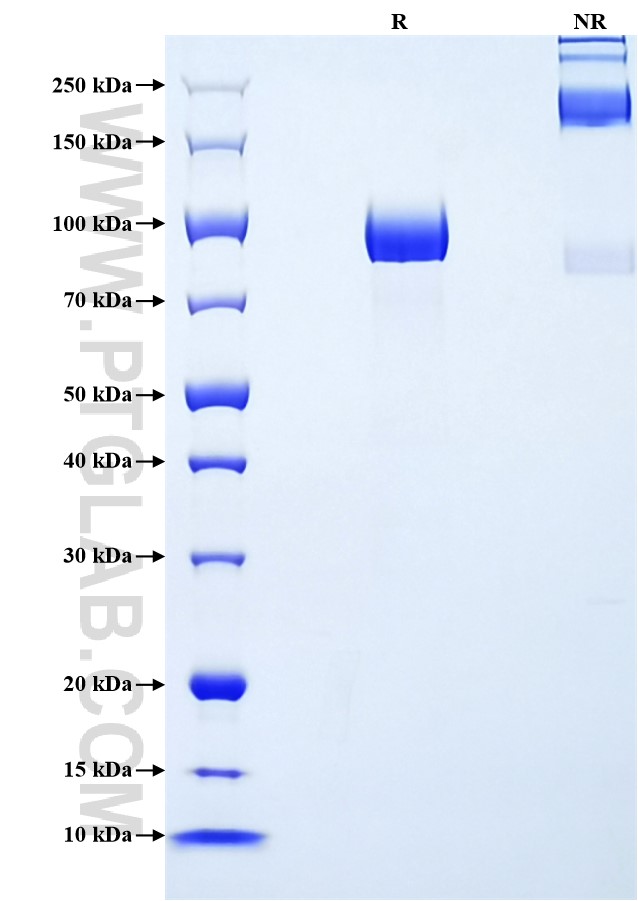 Purity of Recombinant Human EPHA3 was determined by SDS-PAGE. The protein was resolved in an SDS-PAGE in reducing (R) and non-reducing (NR) conditions and stained using Coomassie blue. Purity of Recombinant Human EPHA3 was determined by SDS-PAGE. The protein was resolved in an SDS-PAGE in reducing (R) and non-reducing (NR) conditions and stained using Coomassie blue.