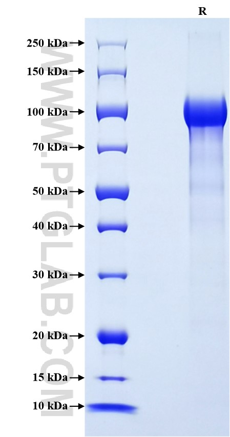 Purity of Recombinant Human Progranulin was determined by SDS-PAGE. The protein was resolved in an SDS-PAGE in reducing (R) conditions and stained using Coomassie blue.