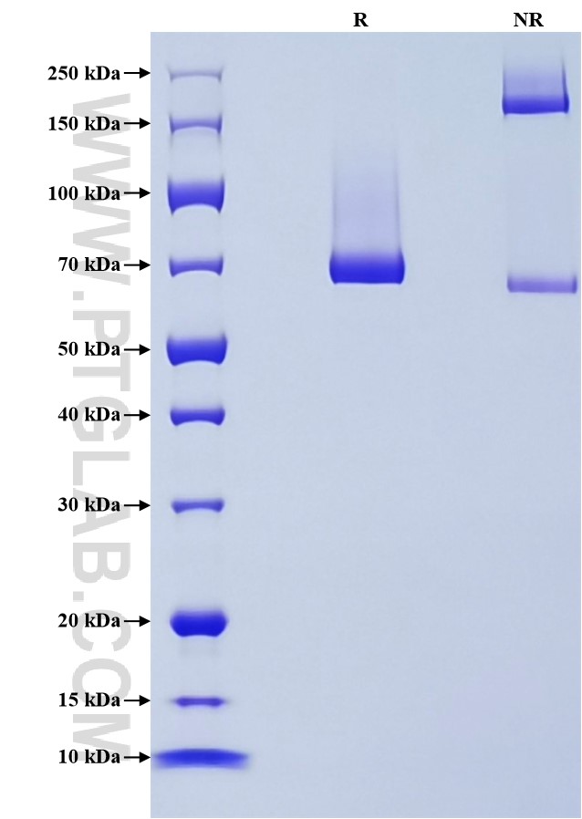 Purity of Recombinant Mouse Decorin was determined by SDS-PAGE. The protein was resolved in an SDS-PAGE in reducing (R) and non-reducing (NR) conditions and stained using Coomassie blue.