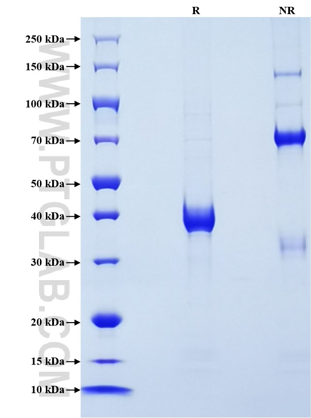 Purity of Recombinant Mouse Ccl6 was determined by SDS-PAGE. The protein was resolved in an SDS-PAGE in reducing (R) and non-reducing (NR) conditions and stained using Coomassie blue.