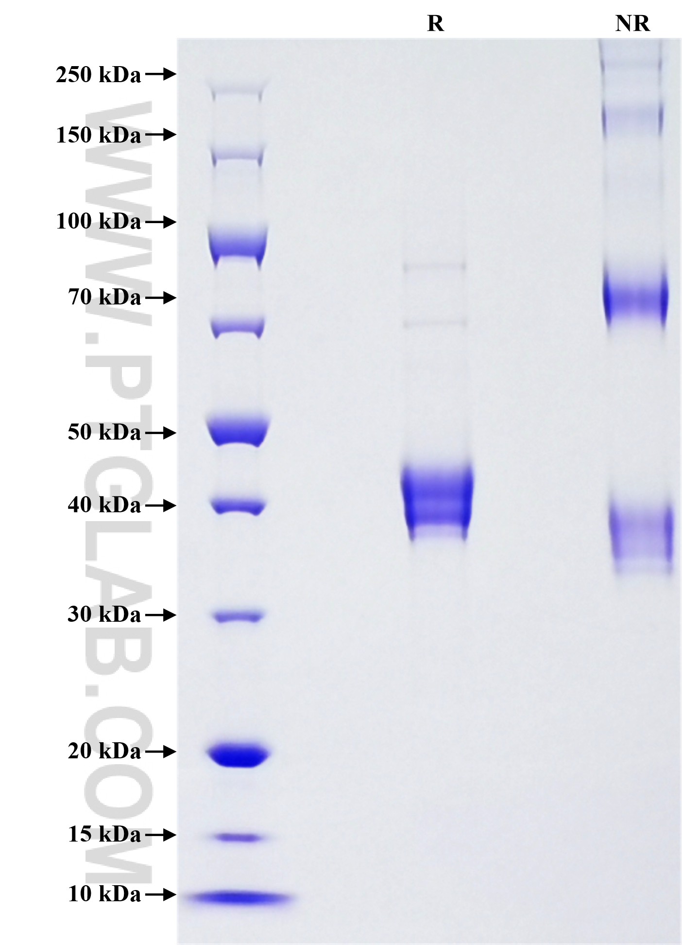 Purity of Recombinant Mouse S100A8 was determined by SDS-PAGE. The protein was resolved in an SDS-PAGE in reducing (R) and non-reducing (NR) conditions and stained using Coomassie blue.