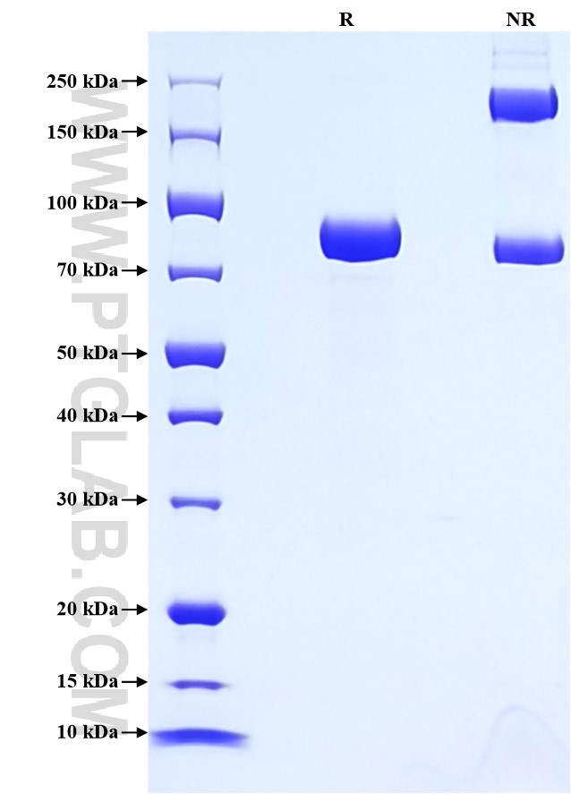 Purity of Recombinant Mouse ALPPL2 was determined by SDS-PAGE. The protein was resolved in an SDS-PAGE in reducing (R) and non-reducing (NR) conditions and stained using Coomassie blue. Purity of Recombinant Mouse ALPPL2 was determined by SDS-PAGE. The protein was resolved in an SDS-PAGE in reducing (R) and non-reducing (NR) conditions and stained using Coomassie blue.