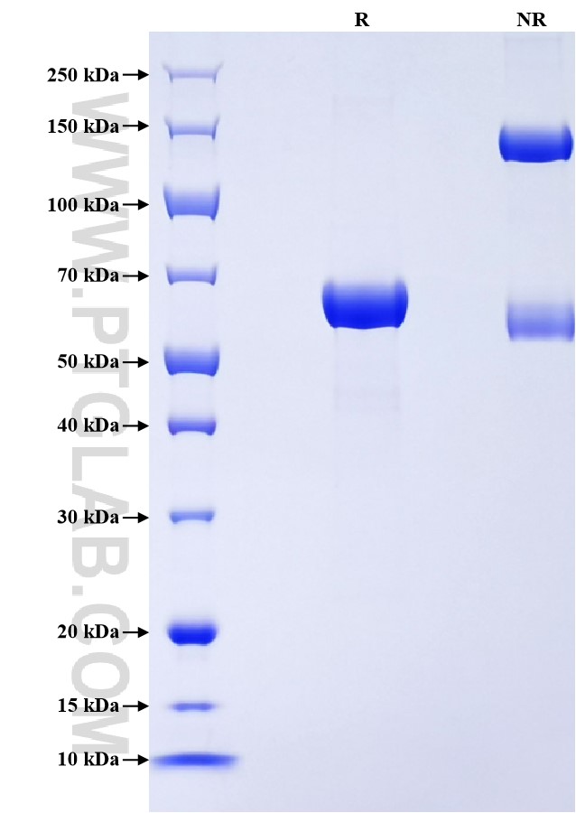 Purity of Recombinant Human Carbonic Anhydrase 6 was determined by SDS-PAGE. The protein was resolved in an SDS-PAGE in reducing (R) and non-reducing (NR) conditions and stained using Coomassie blue.