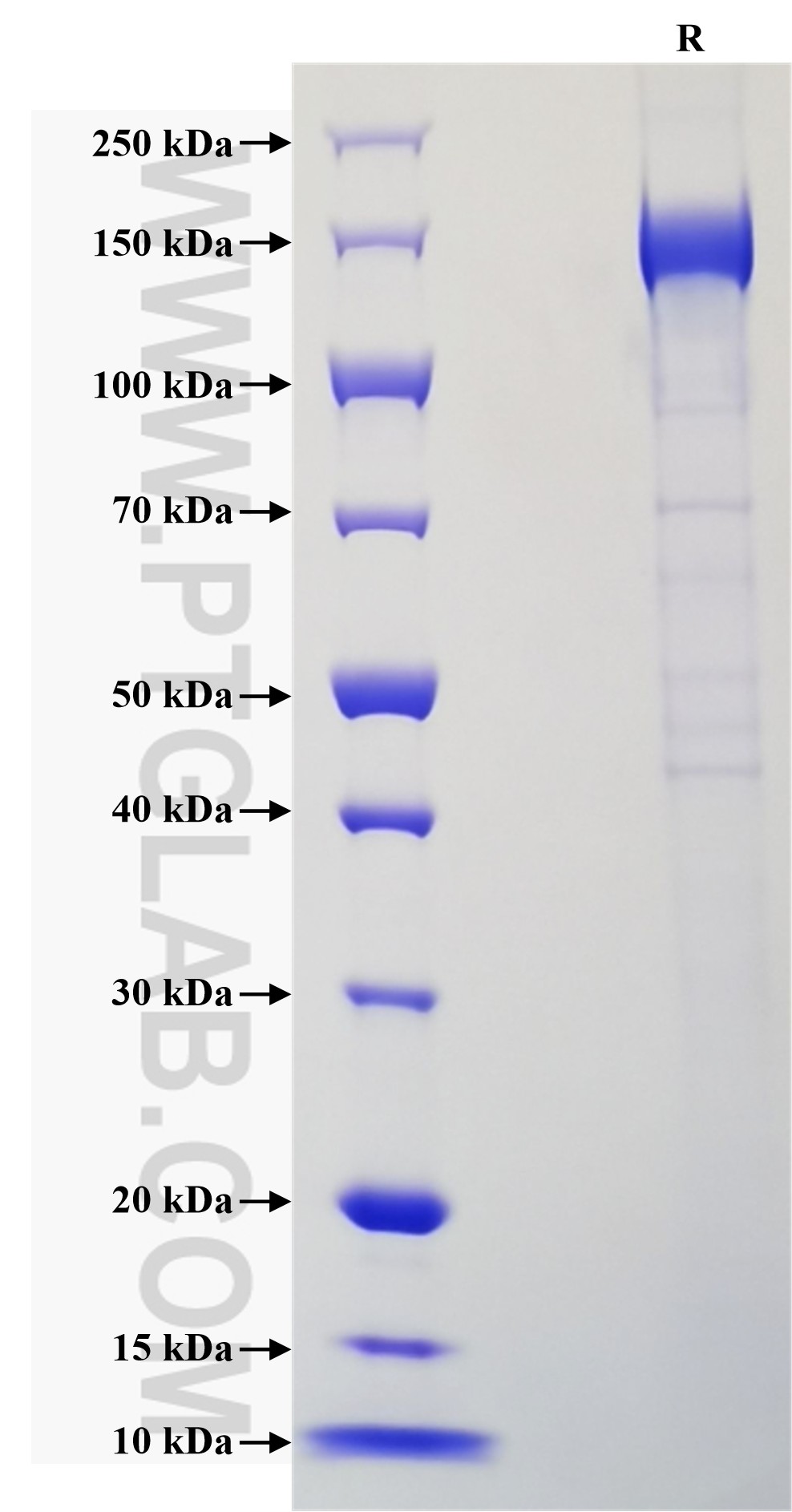 Purity of Recombinant Human CD21 was determined by SDS-PAGE. The protein was resolved in an SDS-PAGE in reducing (R) conditions and stained using Coomassie blue.