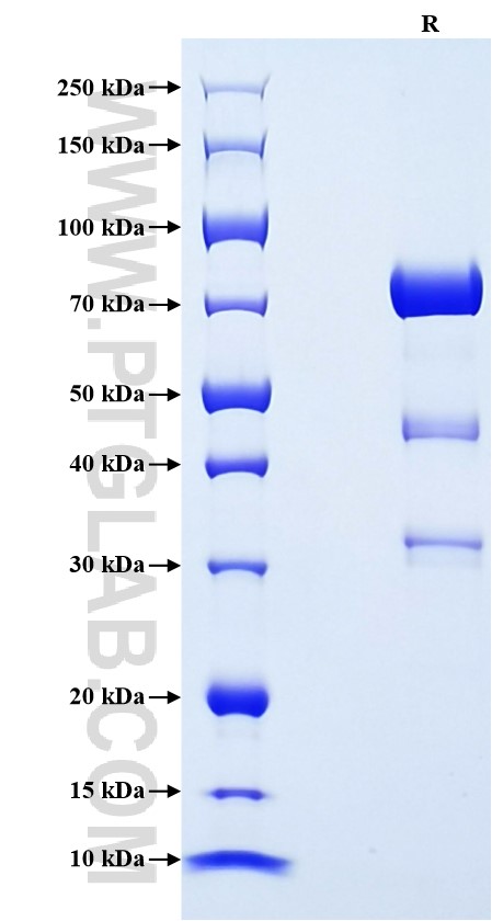 Purity of Recombinant Human CPE was determined by SDS-PAGE. The protein was resolved in an SDS-PAGE in reducing (R) condition and stained using Coomassie blue.