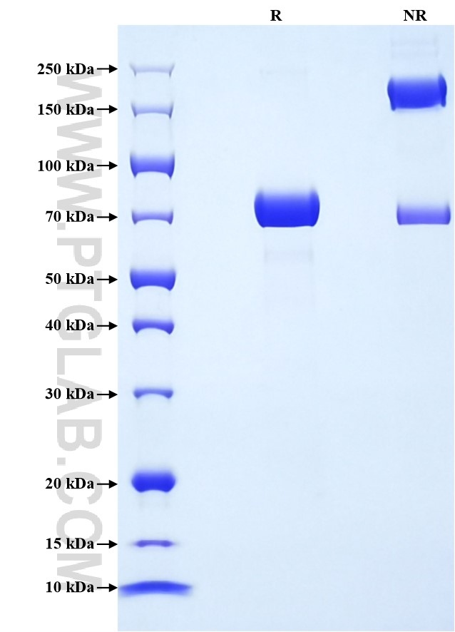 Purity of Recombinant Human PNLIP was determined by SDS-PAGE. The protein was resolved in an SDS-PAGE in reducing (R) and non-reducing (NR) conditions and stained using Coomassie blue.