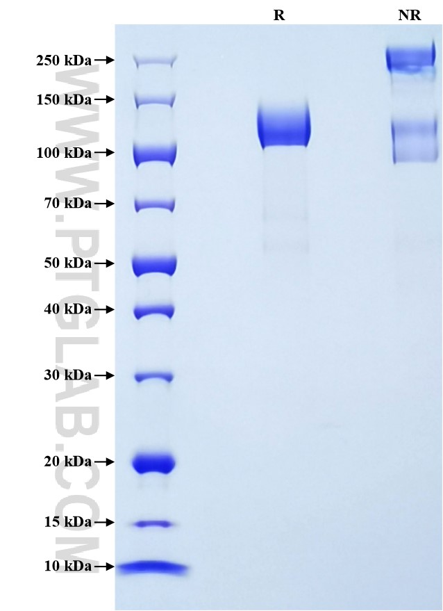 Purity of Recombinant Human ACAN was determined by SDS-PAGE. The protein was resolved in an SDS-PAGE in reducing (R) and non-reducing (NR) conditions and stained using Coomassie blue.