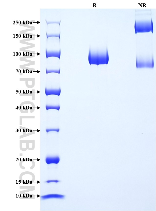 Purity of Recombinant Mouse TrkB was determined by SDS-PAGE. The protein was resolved in an SDS-PAGE in reducing (R) and non-reducing (NR) conditions and stained using Coomassie blue. Purity of Recombinant Mouse TrkB was determined by SDS-PAGE. The protein was resolved in an SDS-PAGE in reducing (R) and non-reducing (NR) conditions and stained using Coomassie blue.