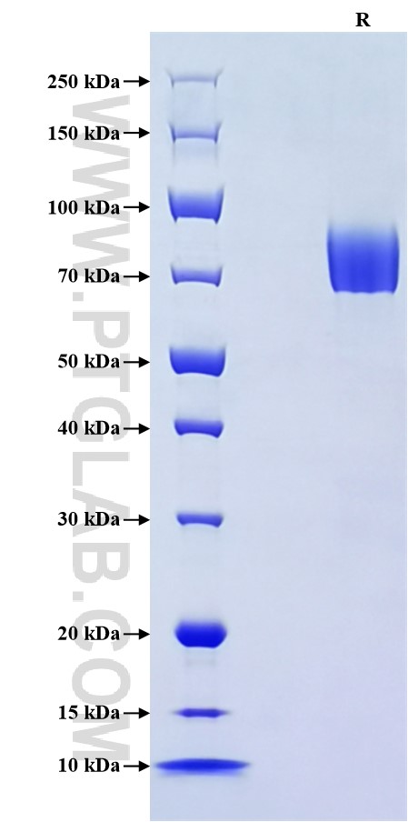 Purity of Recombinant Human CD62L was determined by SDS-PAGE. The protein was resolved in an SDS-PAGE in reducing (R) conditions and stained using Coomassie blue.