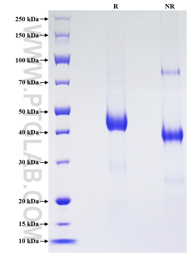 Purity of Recombinant Human PIP was determined by SDS-PAGE. The protein was resolved in an SDS-PAGE in reducing (R) and non-reducing (NR) conditions and stained using Coomassie blue.
