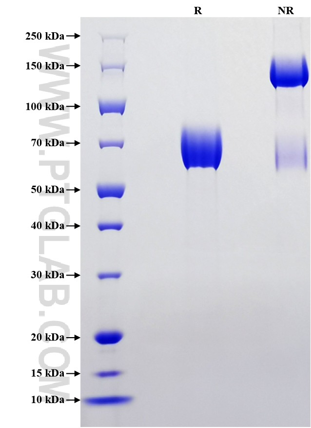 Purity of Recombinant Human GHR was determined by SDS-PAGE. The protein was resolved in an SDS-PAGE in reducing (R) and non-reducing (NR) conditions and stained using Coomassie blue.