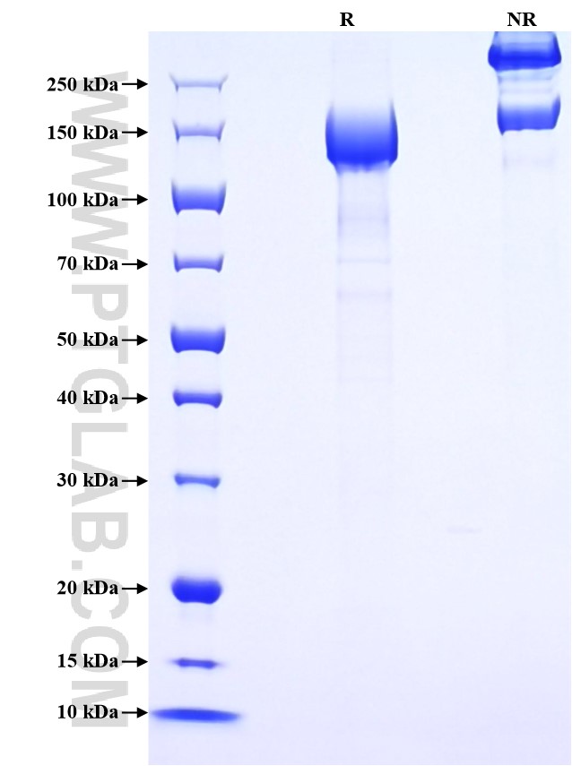 Purity of Recombinant Mouse NID1 was determined by SDS-PAGE. The protein was resolved in an SDS-PAGE in reducing (R) and non-reducing (NR) conditions and stained using Coomassie blue.