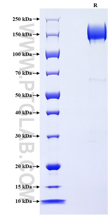 Purity of Recombinant Mouse ACE was determined by SDS-PAGE. The protein was resolved in an SDS-PAGE in reducing (R) conditions and stained using Coomassie blue.