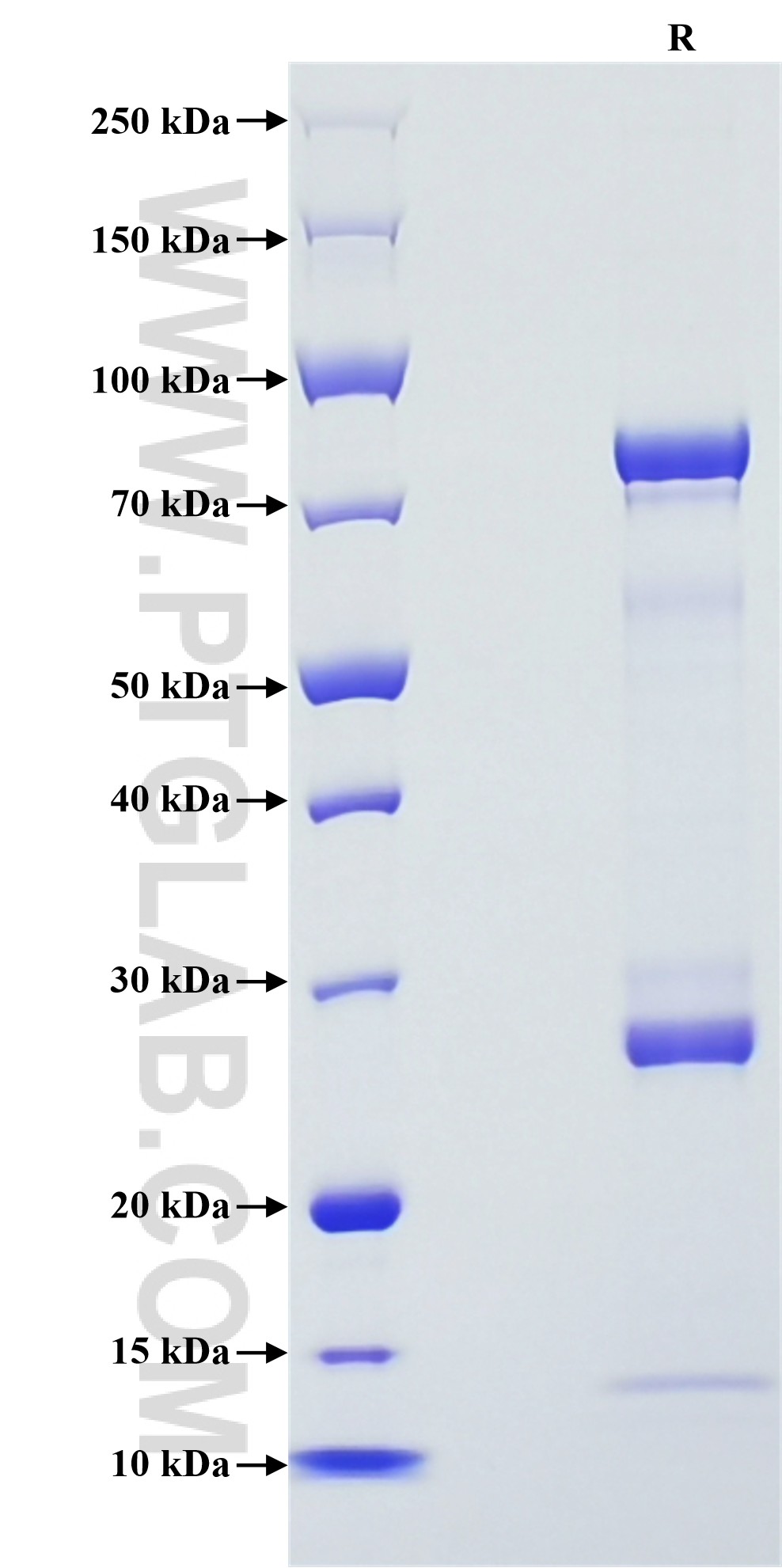 Purity of Recombinant Human MMP10 was determined by SDS-PAGE. The protein was resolved in an SDS-PAGE in reducing (R) conditions and stained using Coomassie blue.
