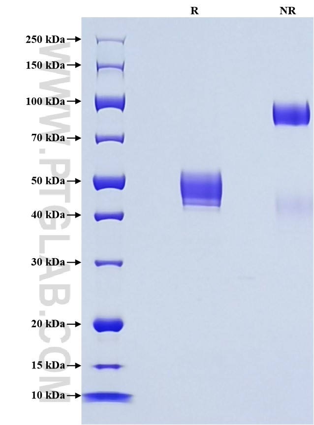 Purity of Recombinant Human RNASE1 was determined by SDS-PAGE. The protein was resolved in an SDS-PAGE in reducing (R) and non-reducing (NR) conditions and stained using Coomassie blue. Purity of Recombinant Human RNASE1 was determined by SDS-PAGE. The protein was resolved in an SDS-PAGE in reducing (R) and non-reducing (NR) conditions and stained using Coomassie blue.