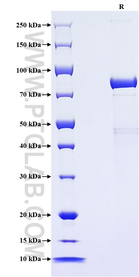 Purity of Recombinant Human PDI was determined by SDS-PAGE. The protein was resolved in an SDS-PAGE in reducing (R) conditions and stained using Coomassie blue.