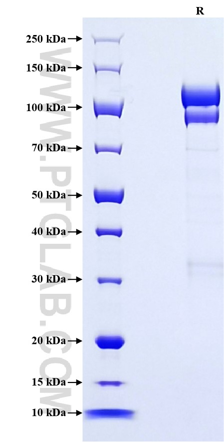 Purity of Recombinant Human Complement C2 was determined by SDS-PAGE. The protein was resolved in an SDS-PAGE in reducing (R) conditions and stained using Coomassie blue.