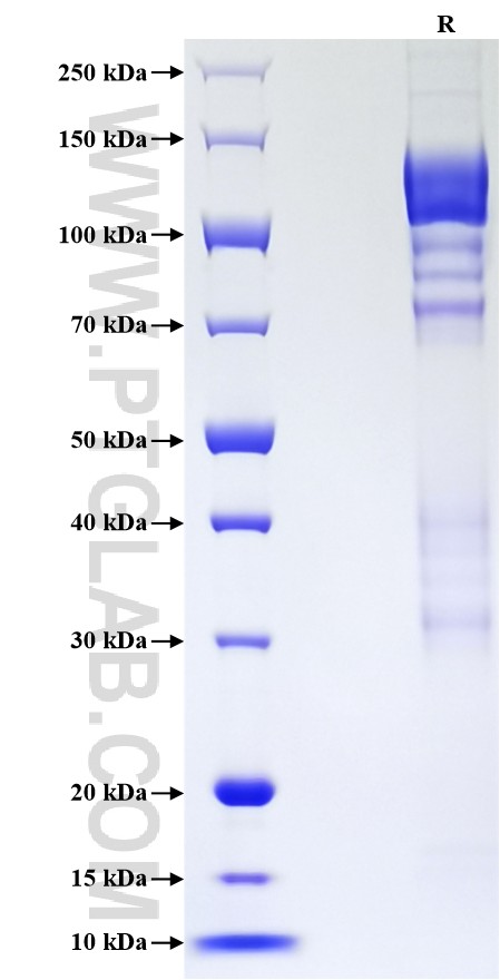 Purity of Recombinant Human APP was determined by SDS-PAGE. The protein was resolved in an SDS-PAGE in reducing (R) conditions and stained using Coomassie blue. Purity of Recombinant Human APP was determined by SDS-PAGE. The protein was resolved in an SDS-PAGE in reducing (R) conditions and stained using Coomassie blue.