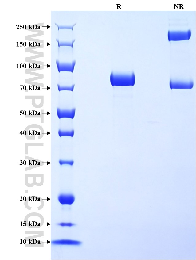 Purity of Recombinant Human Pancreatic alpha-amylase 
was determined by SDS-PAGE. The protein was resolved in an SDS-PAGE in reducing (R) and non-reducing (NR) conditions and stained using Coomassie blue.