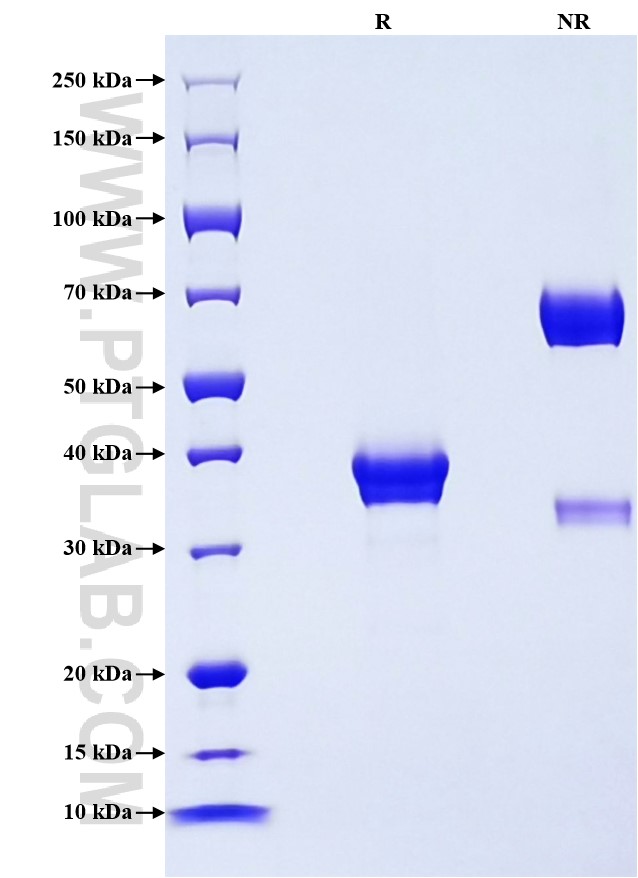 Purity of Recombinant Human TFF1 was determined by SDS-PAGE. The protein was resolved in an SDS-PAGE in reducing (R) and non-reducing (NR) conditions and stained using Coomassie blue. Purity of Recombinant Human TFF1 was determined by SDS-PAGE. The protein was resolved in an SDS-PAGE in reducing (R) and non-reducing (NR) conditions and stained using Coomassie blue.