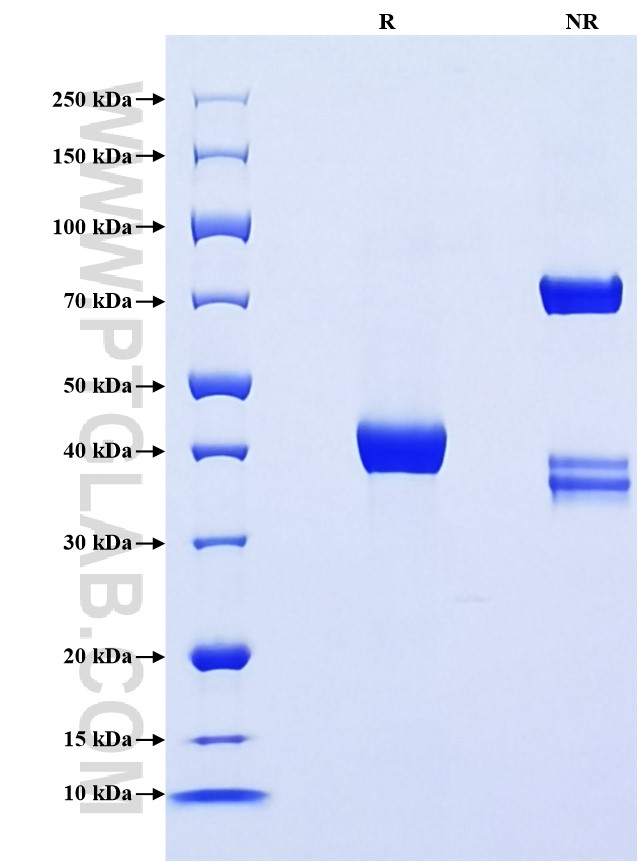 Purity of Recombinant Human PLA2G1B was determined by SDS-PAGE. The protein was resolved in an SDS-PAGE in reducing (R) and non-reducing (NR) conditions and stained using Coomassie blue.