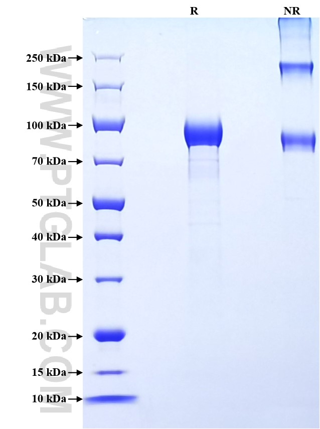 Purity of Recombinant Human Hemopexin was determined by SDS-PAGE. The protein was resolved in an SDS-PAGE in reducing (R) and non-reducing (NR) conditions and stained using Coomassie blue. Purity of Recombinant Human Hemopexin was determined by SDS-PAGE. The protein was resolved in an SDS-PAGE in reducing (R) and non-reducing (NR) conditions and stained using Coomassie blue.