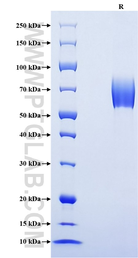 Purity of Recombinant Mouse CD25 was determined by SDS-PAGE. The protein was resolved in an SDS-PAGE in reducing (R) conditions and stained using Coomassie blue.