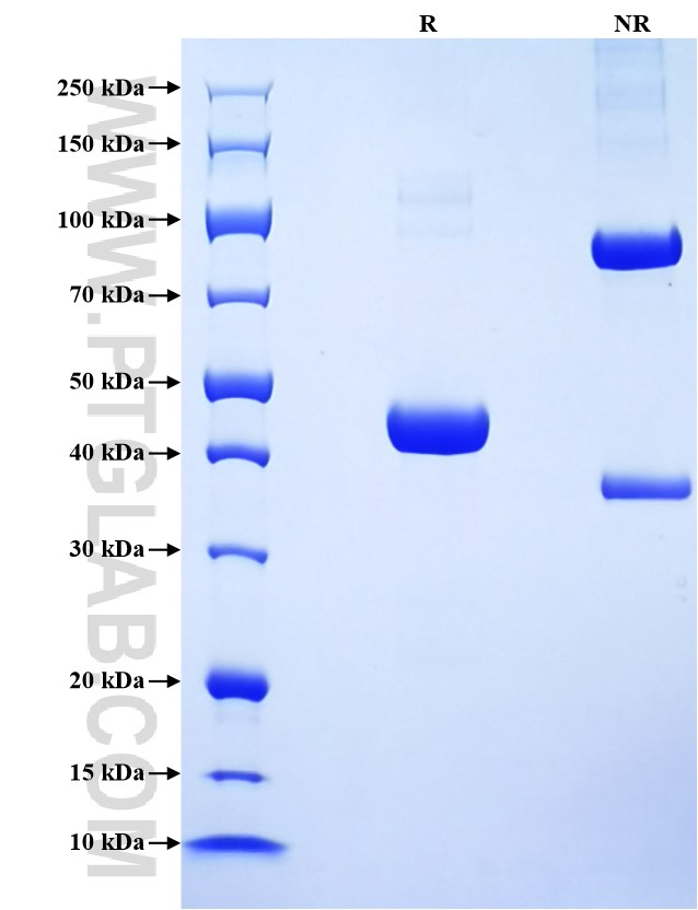 Purity of Recombinant Human IFNA17 was determined by SDS-PAGE. The protein was resolved in an SDS-PAGE in reducing (R) and non-reducing (NR) conditions and stained using Coomassie blue.