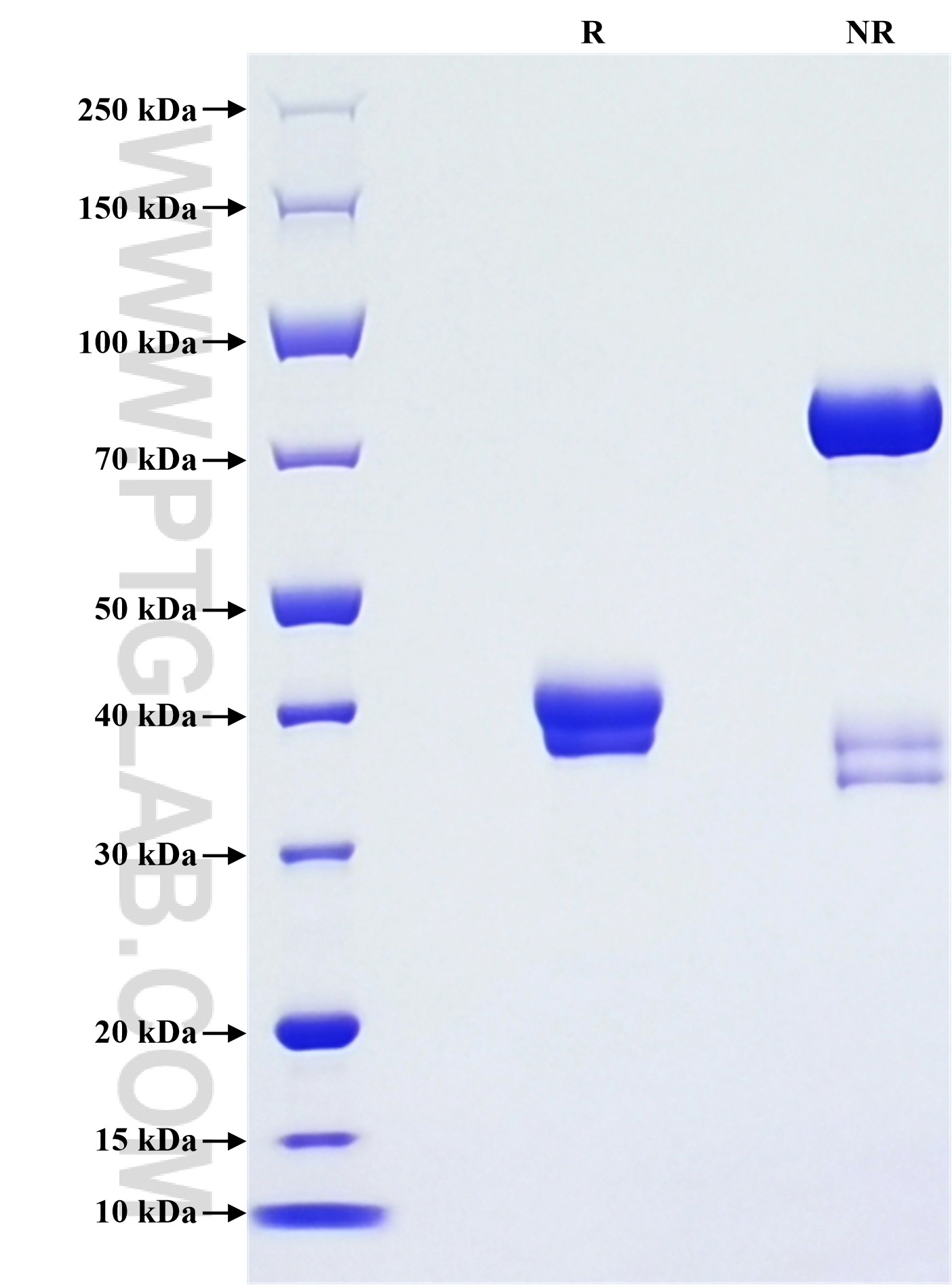 Purity of Recombinant Human Gastrin was determined by SDS-PAGE. The protein was resolved in an SDS-PAGE in reducing (R) and non-reducing (NR) conditions and stained using Coomassie blue.