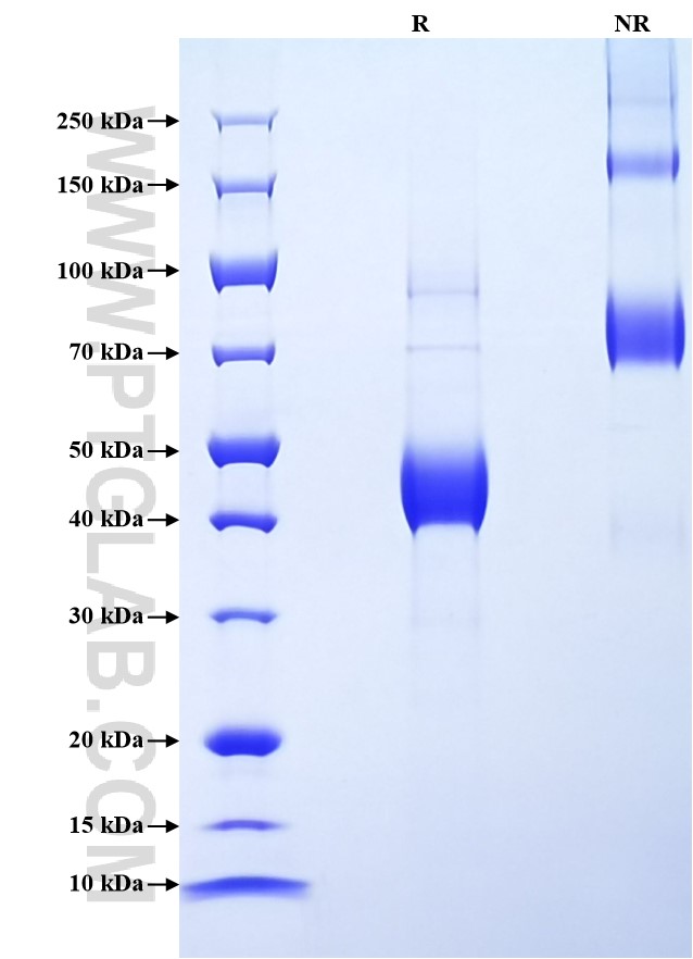 Purity of Recombinant Mouse Cga was determined by SDS-PAGE. The protein was resolved in an SDS-PAGE in reducing (R) and non-reducing (NR) conditions and stained using Coomassie blue. Purity of Recombinant Mouse Cga was determined by SDS-PAGE. The protein was resolved in an SDS-PAGE in reducing (R) and non-reducing (NR) conditions and stained using Coomassie blue.