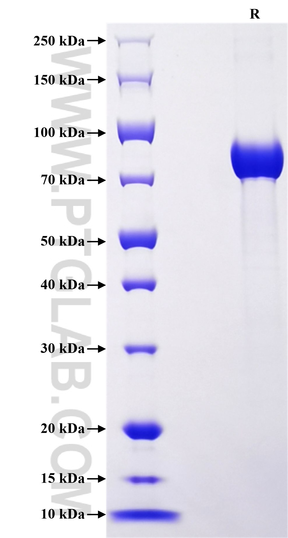 Purity of Recombinant Human SERPINC1 was determined by SDS-PAGE. The protein was resolved in an SDS-PAGE in reducing (R) conditions and stained using Coomassie blue.