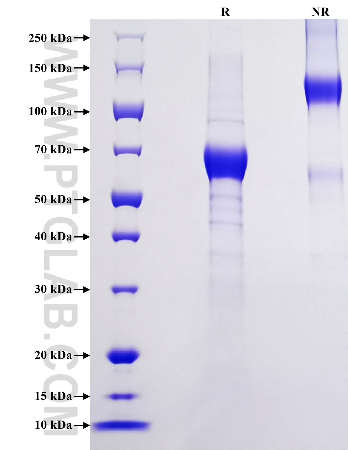 Purity of Recombinant Human DKK1 was determined by SDS-PAGE. The protein was resolved in an SDS-PAGE in reducing (R) and non-reducing (NR) conditions and stained using Coomassie blue. Purity of Recombinant Human DKK1 was determined by SDS-PAGE. The protein was resolved in an SDS-PAGE in reducing (R) and non-reducing (NR) conditions and stained using Coomassie blue.