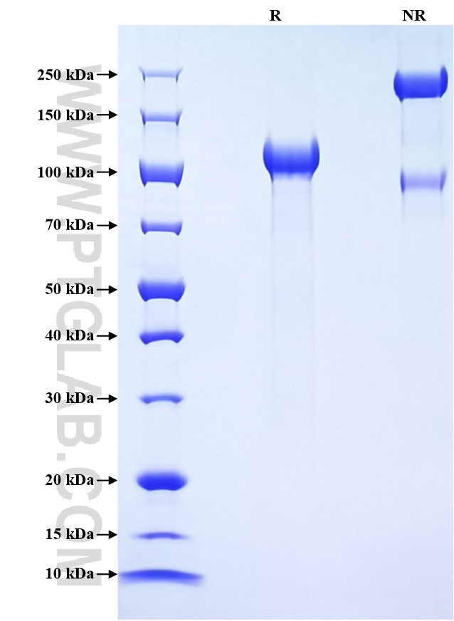 Purity of Recombinant Mouse CD93 was determined by SDS-PAGE. The protein was resolved in an SDS-PAGE in reducing (R) and non-reducing (NR) conditions and stained using Coomassie blue. Purity of Recombinant Mouse CD93 was determined by SDS-PAGE. The protein was resolved in an SDS-PAGE in reducing (R) and non-reducing (NR) conditions and stained using Coomassie blue.