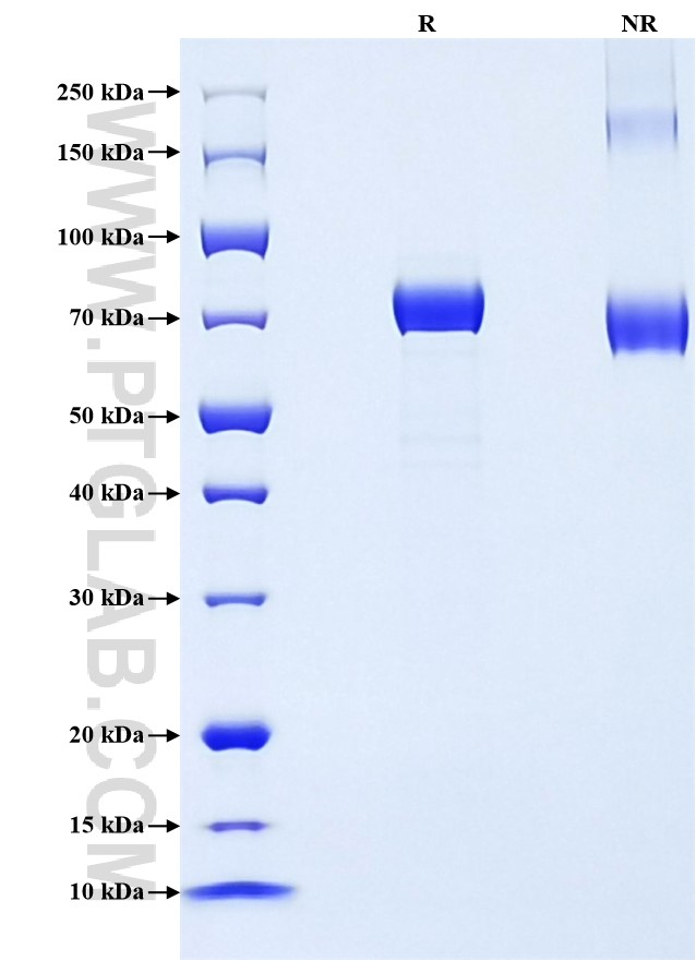 Purity of Recombinant Mouse IL-13RA2 was determined by SDS-PAGE. The protein was resolved in an SDS-PAGE in reducing (R) and non-reducing (NR) conditions and stained using Coomassie blue.