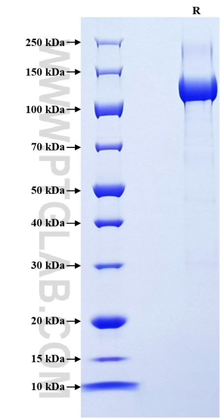 Purity of Recombinant Human Neuropilin 2 was determined by SDS-PAGE. The protein was resolved in an SDS-PAGE in reducing (R) conditions and stained using Coomassie blue.
