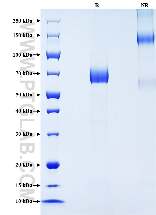 Purity of Recombinant Mouse TFPI was determined by SDS-PAGE. The protein was resolved in an SDS-PAGE in reducing (R) and non-reducing (NR) conditions and stained using Coomassie blue. Purity of Recombinant Mouse TFPI was determined by SDS-PAGE. The protein was resolved in an SDS-PAGE in reducing (R) and non-reducing (NR) conditions and stained using Coomassie blue.