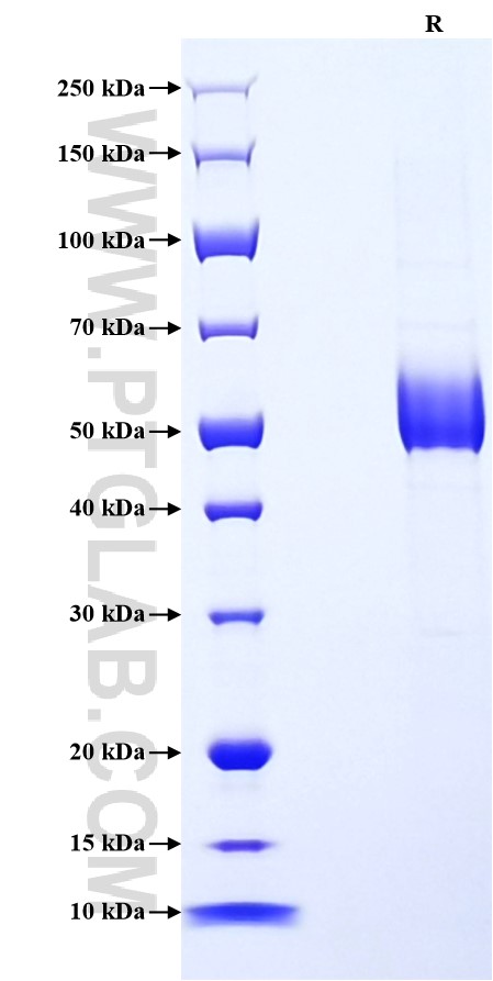Purity of Recombinant Human SPINT2 was determined by SDS-PAGE. The protein was resolved in an SDS-PAGE in reducing (R) conditions and stained using Coomassie blue.