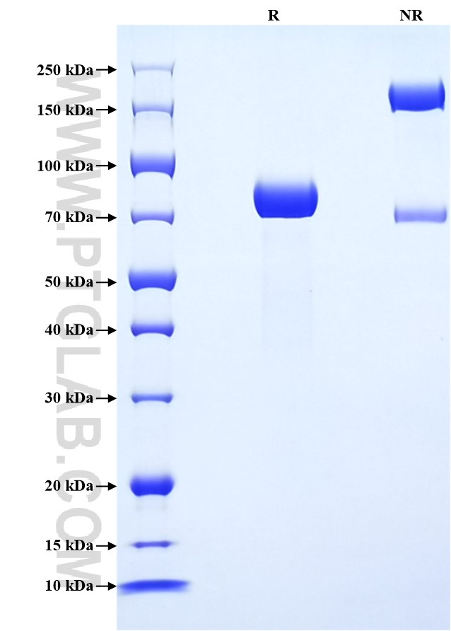 Purity of Recombinant Human SPINT1 was determined by SDS-PAGE. The protein was resolved in an SDS-PAGE in reducing (R) and non-reducing (NR) conditions and stained using Coomassie blue.