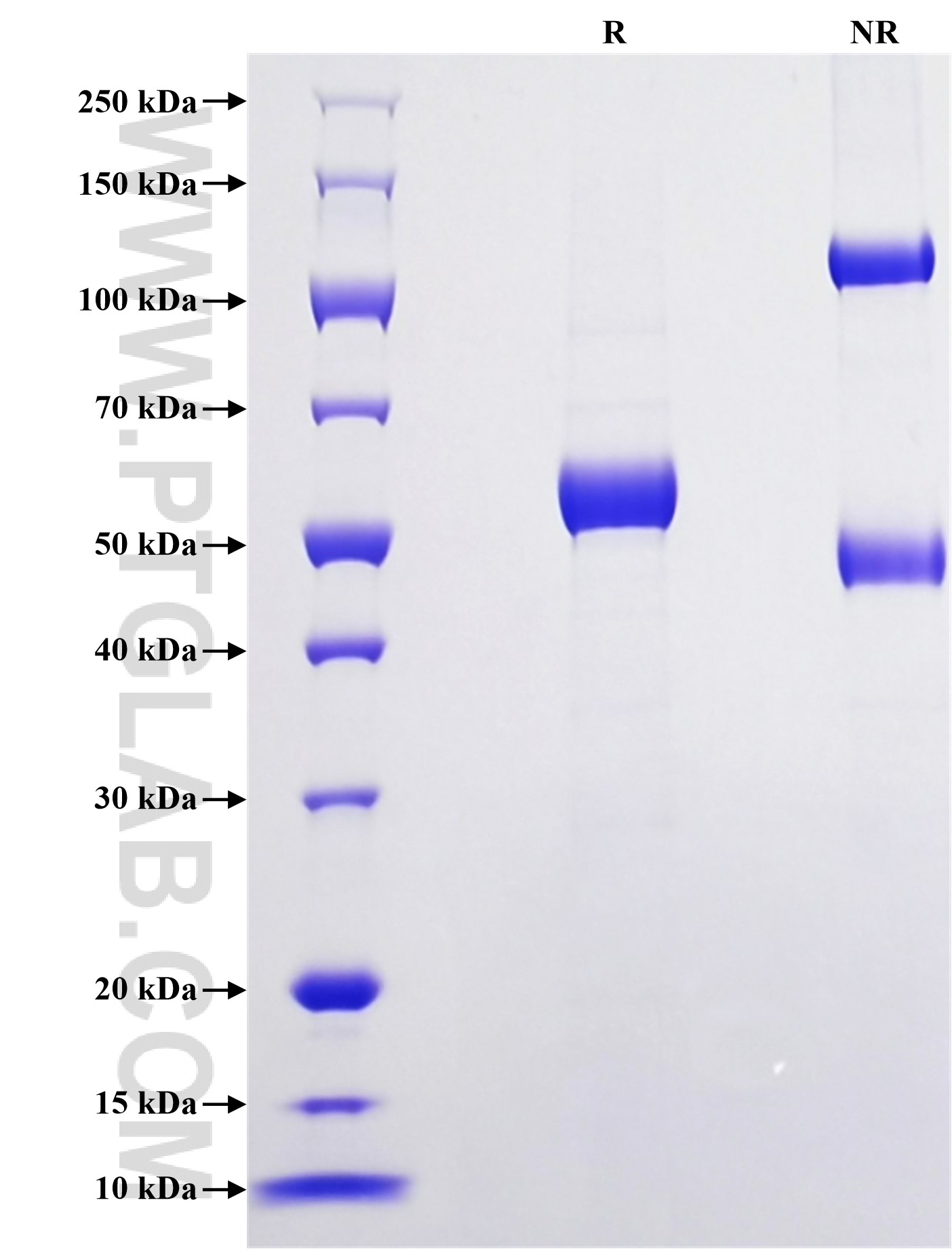 Purity of Recombinant HHuman Kallikrein 10 was determined by SDS-PAGE. The protein was resolved in an SDS-PAGE in reducing (R) and non-reducing (NR) conditions and stained using Coomassie blue.