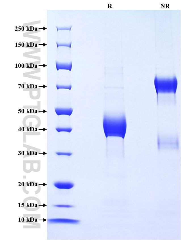 Purity of Recombinant Human CCL16 was determined by SDS-PAGE. The protein was resolved in an SDS-PAGE in reducing (R) and non-reducing (NR) conditions and stained using Coomassie blue. Purity of Recombinant Human CCL16 was determined by SDS-PAGE. The protein was resolved in an SDS-PAGE in reducing (R) and non-reducing (NR) conditions and stained using Coomassie blue.