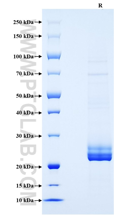 Purity of Recombinant Mouse TNF-alpha was determined by SDS-PAGE. The protein was resolved in an SDS-PAGE in reducing (R) conditions and stained using Coomassie blue.