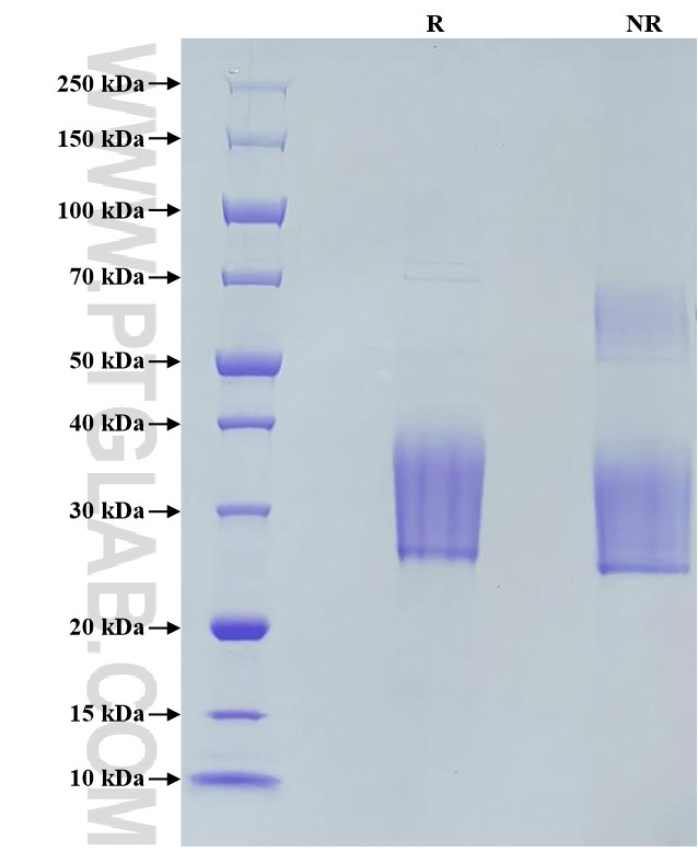 Purity of Recombinant Mouse IL-6 was determined by SDS-PAGE. The protein was resolved in an SDS-PAGE in reducing (R) and non-reducing (NR) conditions and stained using Coomassie blue.