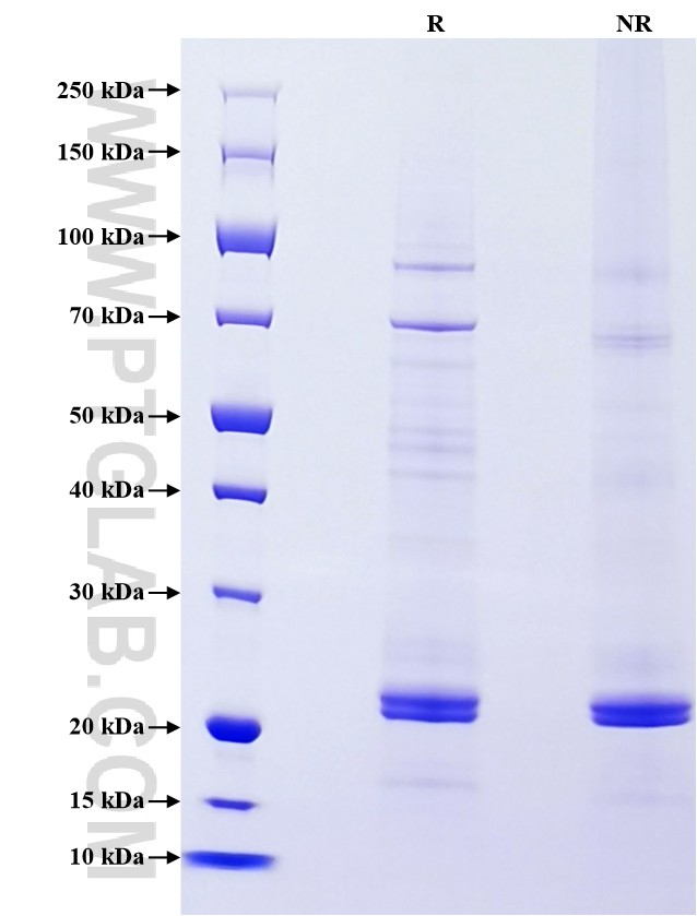 Purity of Recombinant Rat TNF-alpha was determined by SDS-PAGE. The protein was resolved in an SDS-PAGE in reducing (R) and non-reducing (NR) conditions and stained using Coomassie blue. Purity of Recombinant Rat TNF-alpha was determined by SDS-PAGE. The protein was resolved in an SDS-PAGE in reducing (R) and non-reducing (NR) conditions and stained using Coomassie blue.