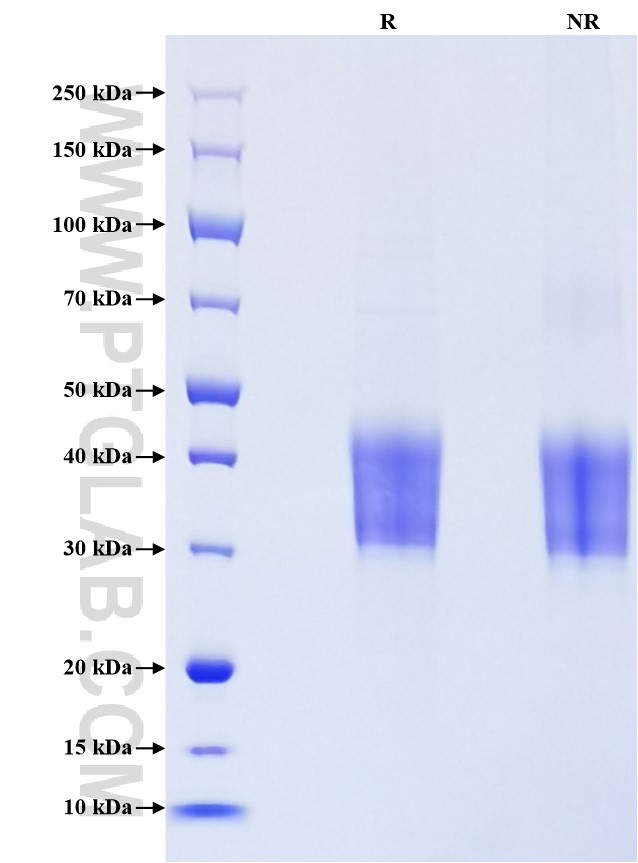 Purity of Recombinant Human KMT2A was determined by SDS-PAGE. The protein was resolved in an SDS-PAGE in reducing (R) and non-reducing (NR) conditions and stained using Coomassie blue. Purity of Recombinant Human KMT2A was determined by SDS-PAGE. The protein was resolved in an SDS-PAGE in reducing (R) and non-reducing (NR) conditions and stained using Coomassie blue.