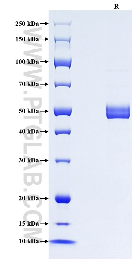 Purity of Recombinant Mouse IL-28B was determined by SDS-PAGE. The protein was resolved in an SDS-PAGE in reducing (R) conditions and stained using Coomassie blue. Purity of Recombinant Mouse IL-28B was determined by SDS-PAGE. The protein was resolved in an SDS-PAGE in reducing (R) conditions and stained using Coomassie blue.