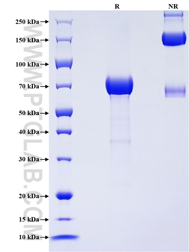 Purity of Recombinant Mouse Fetuin-A was determined by SDS-PAGE. The protein was resolved in an SDS-PAGE in reducing (R) and non-reducing (NR) conditions and stained using Coomassie blue.